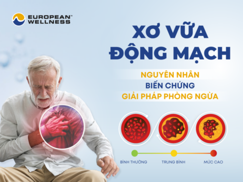 Xo-vua-dong-mach-nguyen-nhan-bien-chung-giai-phap-phong-ngua.png