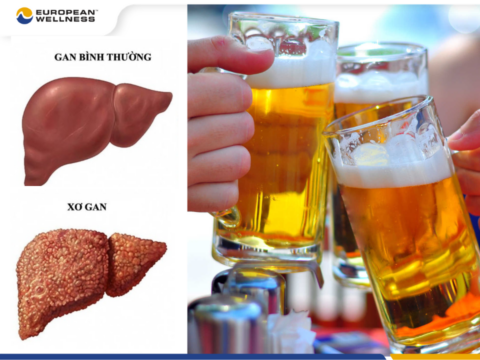 Sử dụng rượu bia, chất kích thích là nguyên nhân khiến gan bị nhiễm độc