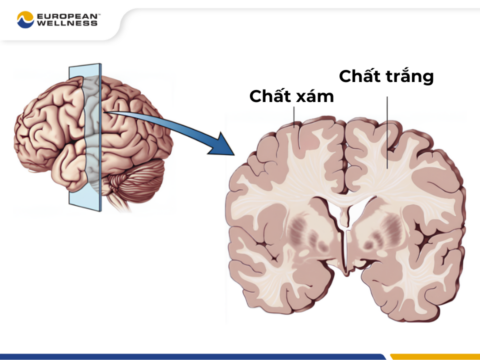 Thoái hóa chất trắng là gì?