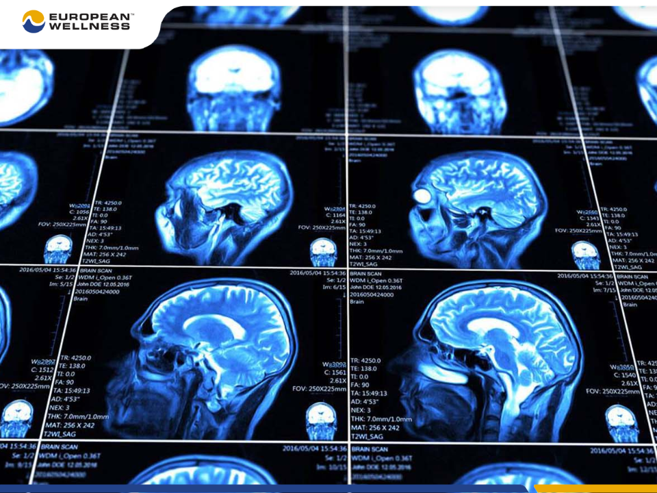 Thoái hóa mạch máu não là tình trạng cần được phát hiện kịp thời